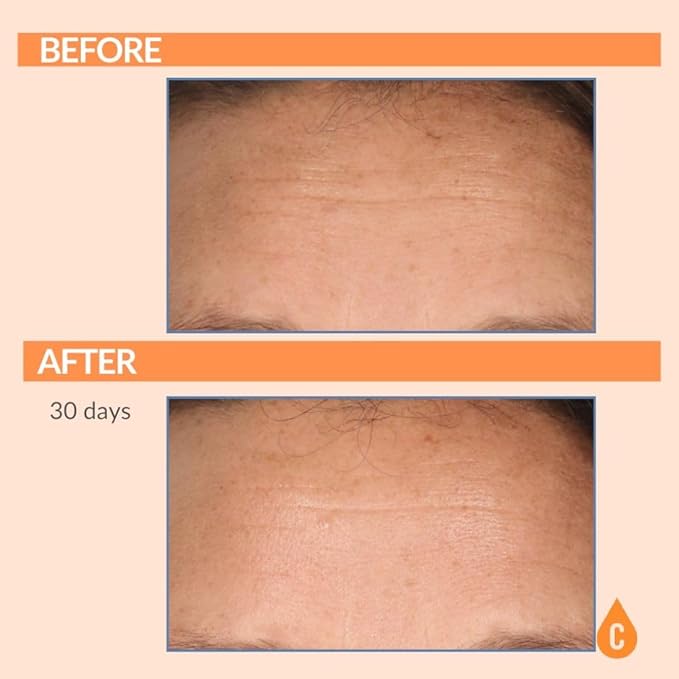 Serious Skincare Vitamin C Anti-Aging Facial Serum with Hydrolyzed Collagen - For Plump, Hydrated Skin - Brightening C3 Plasma Conditioner for Reducing Dark Spots, Fine Lines & Wrinkles 1 Fl Oz