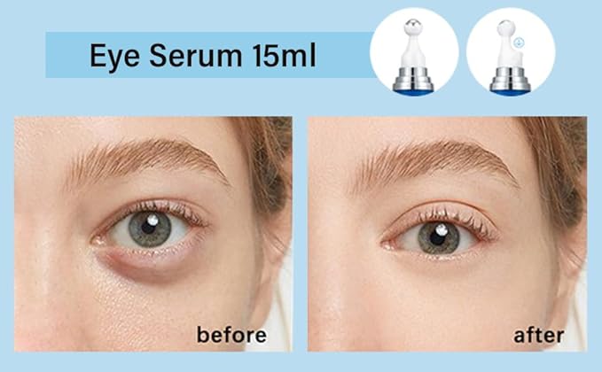 5% Caffeine Eye Serum, Under Eye Roller Cream for Dark Circles and Puffiness with 360°Massage Ball Reduce Wrinkles and Fine Lines,Bags Under Eyes,15ML