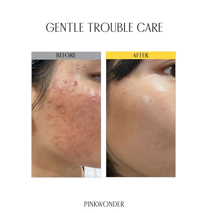 PINKWONDER Tamanu Hero Ampoule⁺ 1.69oz (50ml), 50,000ppm Tamanu Oil for Soothing