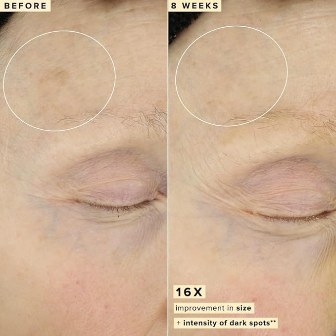 Farmacy 10% Vitamin C Face Serum - Waterless Vitamin C Skin Care Serum to Brighten, Firm + Smooth Skin Texture - Enriched with Upcycled Tangerine Peel to Boost Skin's Moisture + Radiance (5ml)