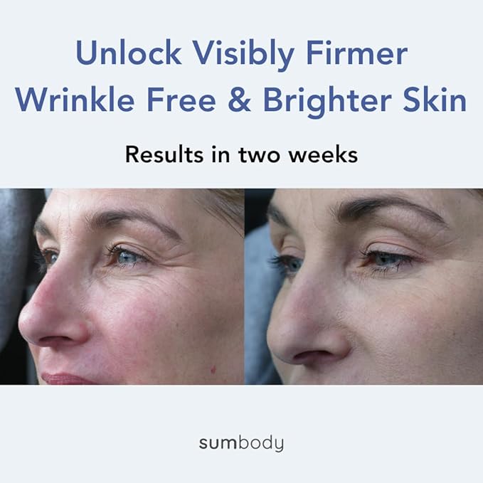 Natural Under Eye Cream Age Defying Plant-Based Retinol Alternative Vegan Eye Repair Moisturizer with Caffeine, antioxidants, Green & white Tea-Prevents Under-eye Wrinkles, Puffiness, Eye Bags