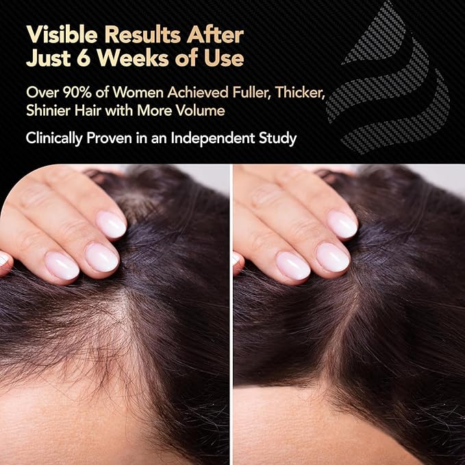 Hair Growth Vitamins for Women with Biotin, Collagen Peptides, Vitamin C & Omega-3 – 90 Capsules – Hair Supplements for Menopause & Postpartum – Hormonal Balance Support & Thicker Hair for Women