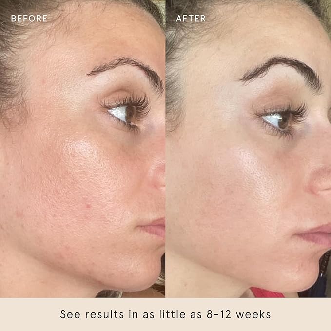 Barefaced Liquid Gold 1 Fl Oz - 15% Vitamin C Serum with Hyaluronic Acid & Vitamin E for Anti-Aging, and Hydration, Antioxidant Formula, Reduces Dark Spots, Acne & Wrinkles