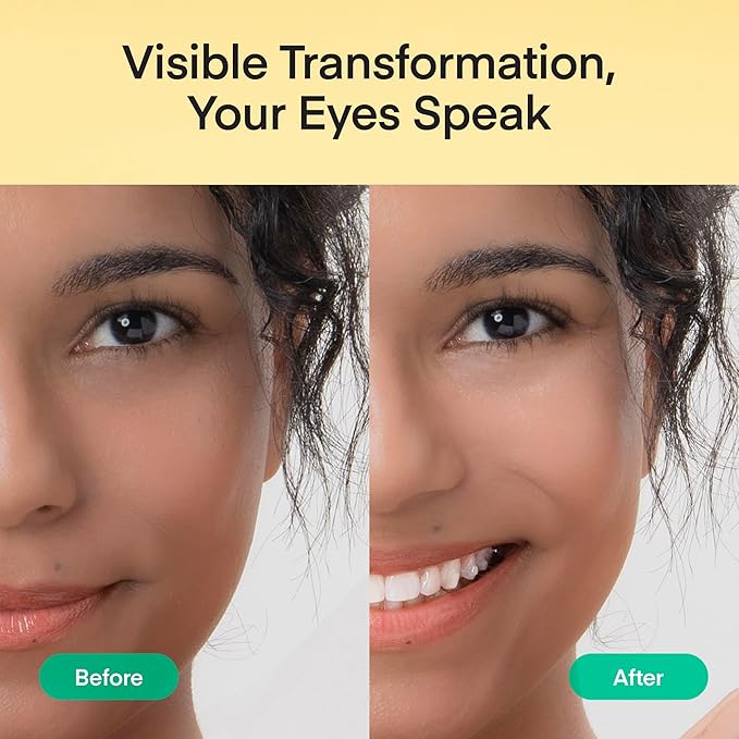 Terez & Honor Under Eye Patches - 180 Pcs Korean Self Care Hydrogel Eye Masks for Puffy Eyes, Dark Circles, Fine Lines, Wrinkles & Undereye Bags - Radiant Eyes Trio with Caffeine, Collagen & Vitamin C