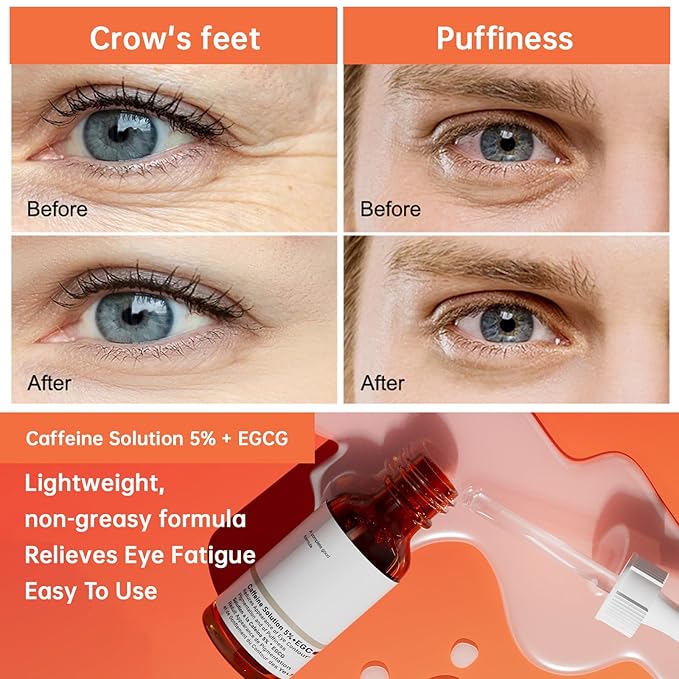 The Caffeine Solution 5% + EGCG,Reduces Appearance of Eye Contour Pigmentation and Puffiness,Under Eye Serum (30ml) Caffeine For Face Moisturizing Serum (1)