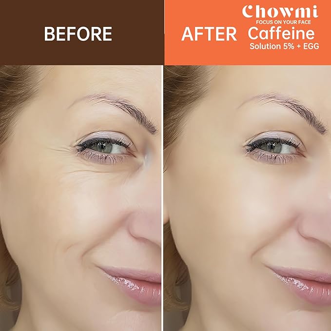 The Caffeine Solution 5% + EGCG,Reduces Appearance of Eye Contour Pigmentation and Puffiness,Under Eye Serum (30ml) Caffeine For Face Moisturizing Serum (1)