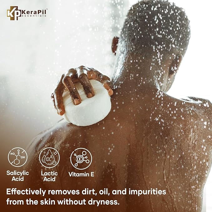 Exfoliating Body Wash with Salicylic Acid - No Dry Out, Gentle Exfoliates Rough and Bumpy Skin, Body Acne Wash, BHA & AHA - Coconut and Vanilla Salicylic Acid Body Wash - (16 fl oz x 2)