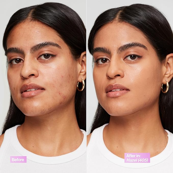 Revlon Illuminance Tinted Serum, Triple Hyaluronic Acid, Evens Out Skin Tone Over Time and Hydrates All Day, SPF 15, 405 Hazel, 0.94 fl oz.