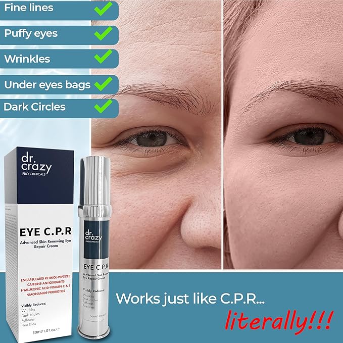 Eye C.P.R | Daily Caffeine & Retinol Under Eye Cream | All in One | Wrinkles & Fine Lines | Firming, Dark Circles, Puffiness | Complex Anti Aging Formula | 30ml
