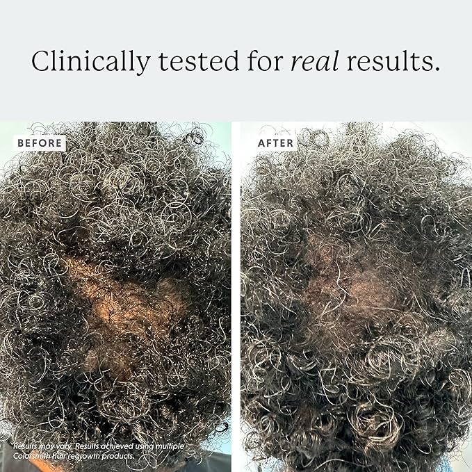 Soothing Scalp Serum, Biotin and Copper Tripeptide Formula, Antioxidant-Rich, 1 fl oz