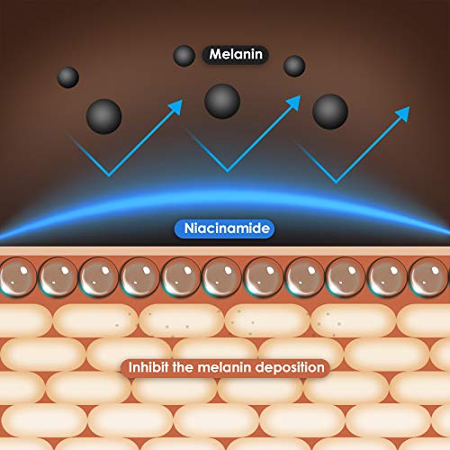 Anti Aging Eye Cream, Retinol Eye Cream Contains Niacinamide and Hyaluronic Acid, Reduces Wrinkles, Puffiness, Crows Feet and Dark Circles, 1 Oz