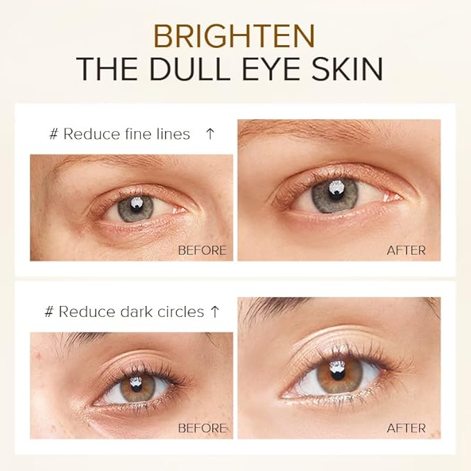 AKARY 24K Gold Eye Serum, Under-eye Firming Serum for Reduces Puffy Eyes, Dark Circles, Fine Lines, Under Eye Bags, Tightening, Hydrating Face Serum, Treatment for Skin Care with Nicotinamide and Vitamin E