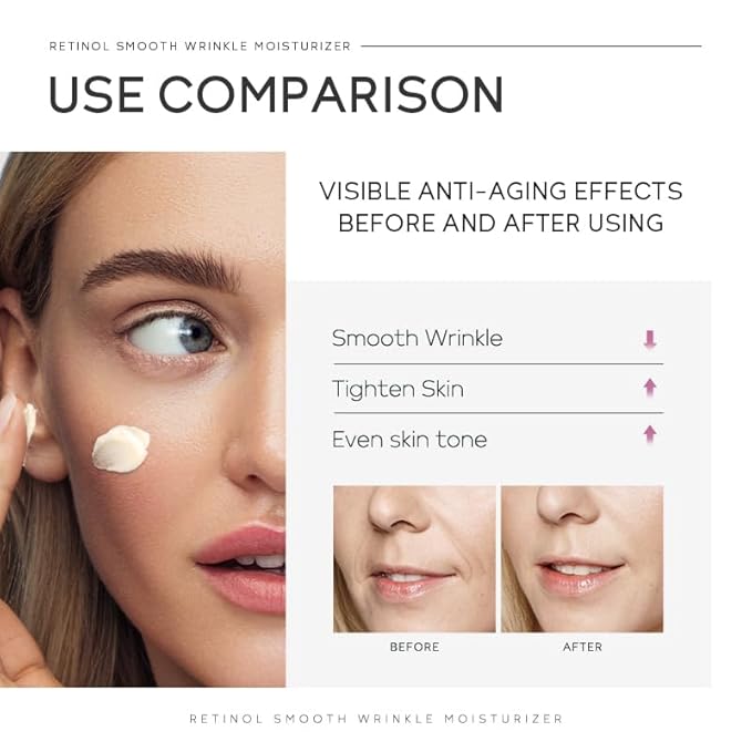 Anti Aging Skin Care Set, 1% Retinol Dark Spot Remover for Face with Face Serum & Moisturizer, Travel Size Skincare Set for Women, Reduce Wrinkles, Firm & Hydrate for All Skin Types