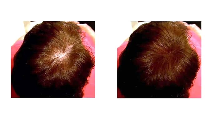 Thinning Hair Solution - All-Natural, Plant-Based Fibers For Fuller, Thicker Appearance. Instantly Covers Bald Spots. Auburn (red/ginger hair). Trial Size, 10-Day Supply