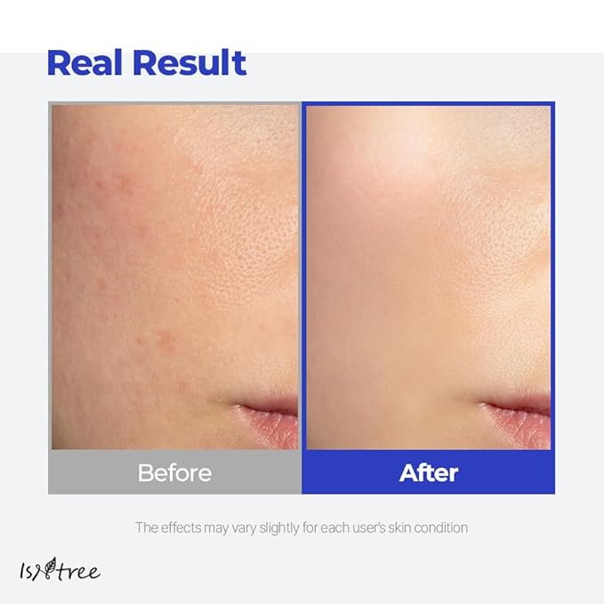 IsNtree Hyaluronic Acid Aqua Gel Cream 100ml, 3.38 fl oz | Korean Skincare | Lightweight Moisturizer | Quick-Absorbing Hydration | For Oily to Combination Skin