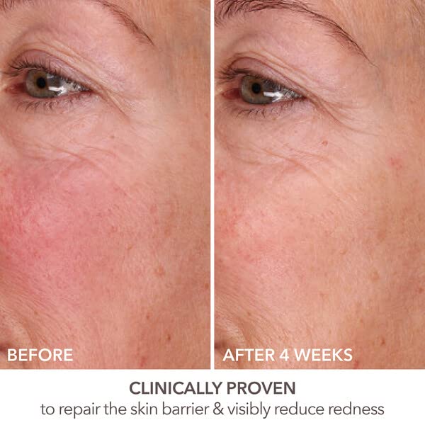 Dr Dennis Gross DermInfusions Fill + Repair Serum: Immediately Fills Lines, Plumps & Repairs, 1 oz