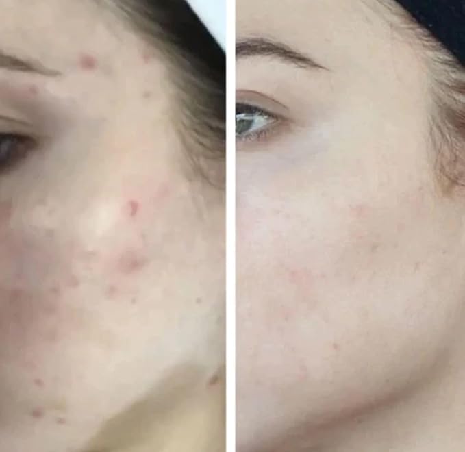 HigherDOSE Light-Activated GLOW SERUM - Anti Aging Face Serum to Plump, Hydrate & Smooth Fine Lines - Made with Vitamin C, Copper Peptides & Hyaluronic Acid - Boosts Benefits of Red Light (1 oz)