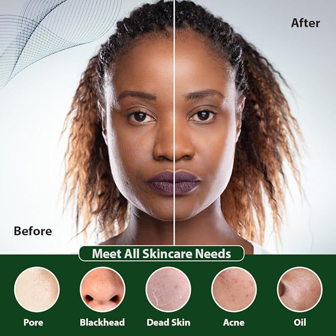 Facial Cleansing Brush | 3-in-1 Electric Face Scrubber | USB Rechargeable Face Cleansing Brush | IPX7 Waterproof | Blackhead Remover | Deep Cleansing & Exfoliating (Green)