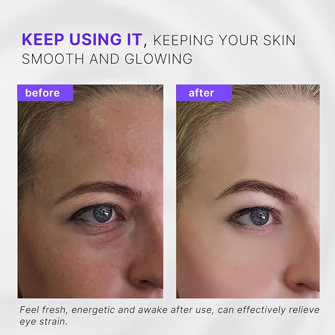 2-in-1 Eye Cream Applicator and Ice Roller, Face Massager Tool for Puffiness, Eye Bags, Muscle Ache