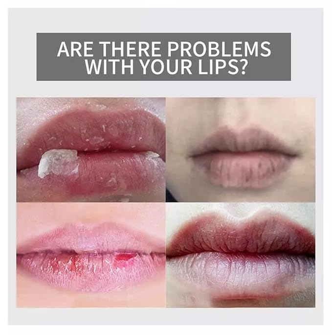 AICHUN BEAUTY Moisturizing Lip Balm Strawberry Smoother Dry Chapped Lips 50g/1.76oz