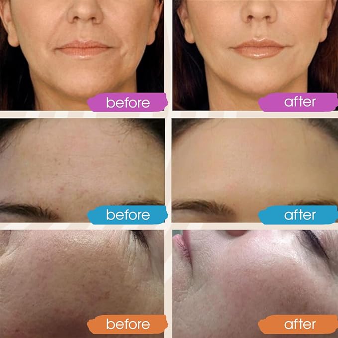 Retinol Serum for Face, Vitamin C with Hyaluronic Acid Face Serum for Women and Men, Glow Skin Care Set Total Package Targets Appearance of Uneven Skin Tone and Dryness 3x1oz