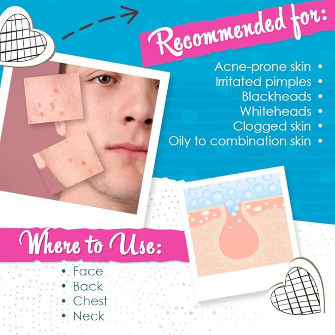 Bye Bye Blemish Acne Drying Lotion, Reduce Pimples Overnight 1oz, 1-Pack