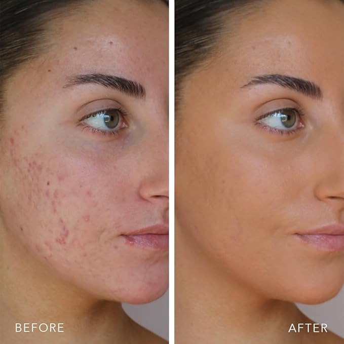 Doll 10 TCE Liquid Filter - Covers, Blurs, and Brightens (Light)