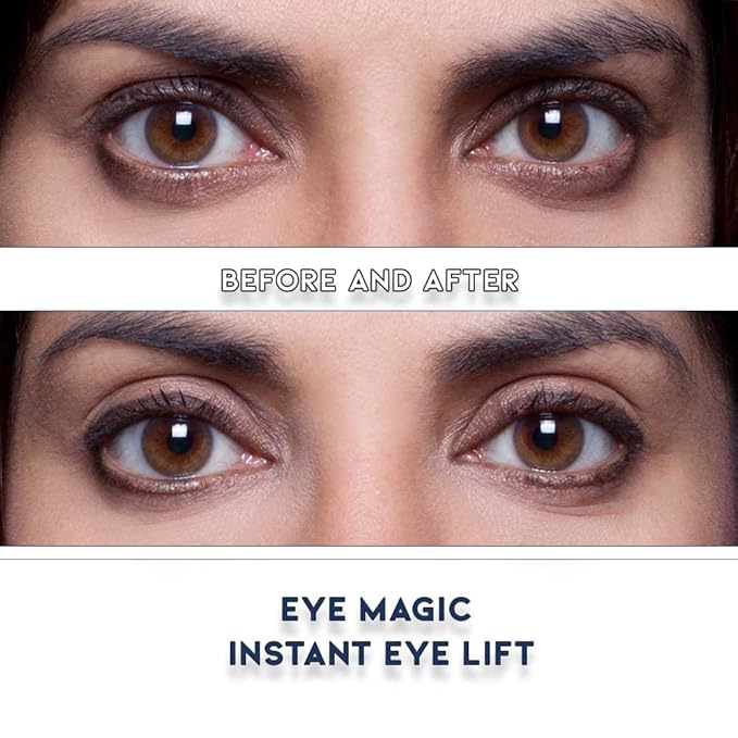 Eye Magic Premium Eye Lift (L/XL Refill) Made in America Lifts and Defines Droopy, Sagging or Hooded Eyes Safe For Daily Use