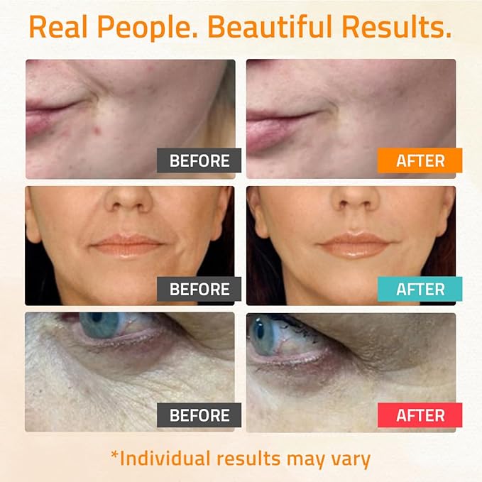 YEOUTH Skin Care Set: Retinol Serum for Face, Vitamin C and Hyaluronic Acid Serum, Face Care Kit that Targets Appearance of Uneven Uneven Skin and Dryness 3x1 oz