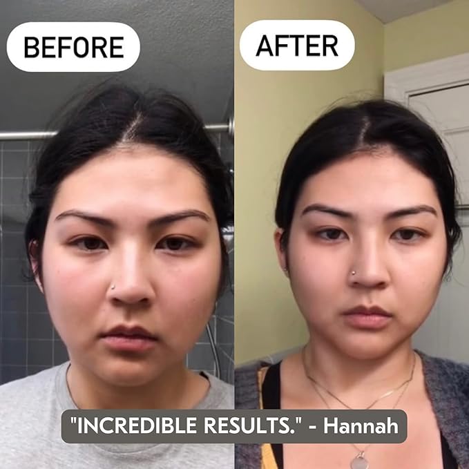 Mount Lai Vitality Qi White Jade Gua Sha Facial Tool – The Imperial Stone of Purity – Patented 5-Sided Professional Sculpting Tool for Lymphatic Drainage, Precision Contouring & Imperial Radiance