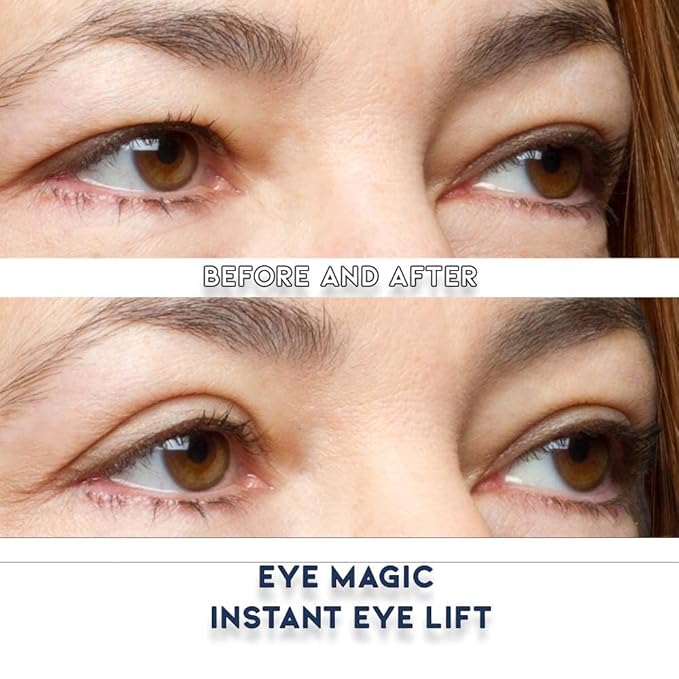 Eye Magic Premium Eyelid Lift (L/XL Kit + Gel) Made in America Lifts and Defines Droopy, Sagging or Hooded Eyes Safe For Daily Use