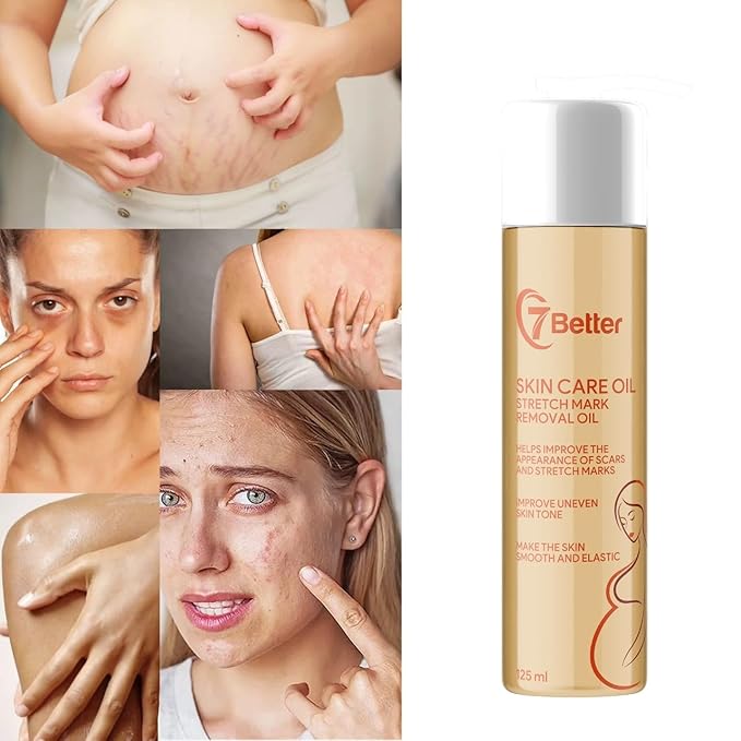 Stretch Mark Pregnancy Oil, Natural Oil Skincare Body Oil Serum for Scars and Stretch Marks, Face with Vitamin E & A for Sensitive Dry Skin and Body Moisturizer