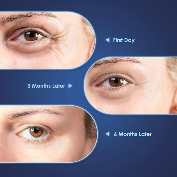 Brightening Vitamin C Eye Gel Cream for Dark Circles & Puffiness, Eye Cream to Help Reduce Fine Lines & Crow's Feet, Boost Hydrating Under Eye Treatment with Hyaluronic Acid & Peptides