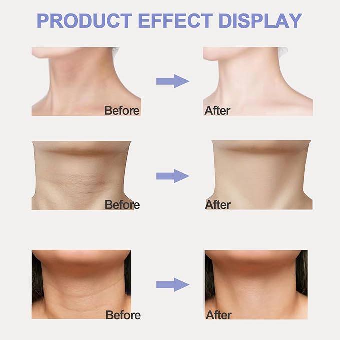 Neck Firming Cream, Neck Tightening Cream, Tighten and Lift Neck Cream, Neck Creams for Tightening and Firming Sagging Skin, Help Reduce Fine Lines & Wrinkles