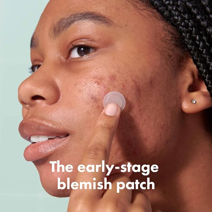 Mighty Patch Micropoint Large Hydrocolloid Pimple Patches for Face Blemishes from Hero Cosmetics, Acne Stickers for Early Stage Zits & Hidden Pimples, 395 Proprietary Micropoints, 8 Count