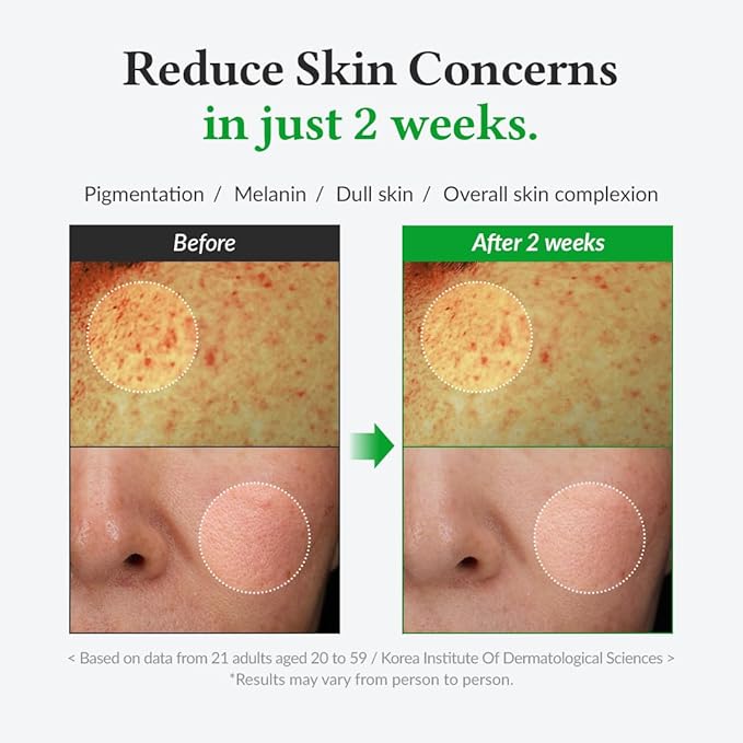 Dr.Althea Gentle Vitamin C Serum | Benefits Skin Tone and Pigmentation | Gentle on Skin For Even Skin Tone | Korean Vegan Skin Care for All Skin Types (Gentle Vitamin C)