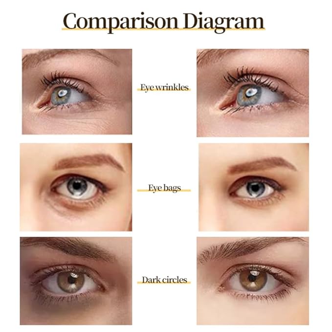 Generic 24 K Gold Eye Mask Puffy Eyes and Dark Circles Treatment Relieve Pressure and Reduce Wrinkles, Revitalize and Refresh Your Skin