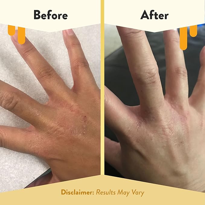 ECZEMA HONEY Premium Witch Hazel & Aloe Spray - Facial Mist Skin Care Product - Unscented Moisturizer, Dewy Makeup Spray, Aftershave & More (8 Oz)