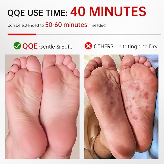 7 Pack Foot Peeling Mask, Hydrating Exfoliating Foot Mask for Dry Cracked Feet, Callus Remover & Cracked Heel Repair & Foot Care