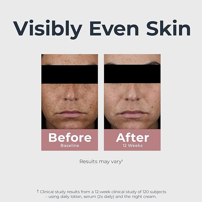 Eucerin Radiant Tone Dual Serum Dark Spot Corrector, Dark Spot Serum with Thiamidol and Hyaluronic Acid, Helps Visibly Reduce the Look of Persistent Dark Spots, 1 Fl Oz Bottle