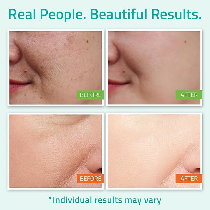 YEOUTH Skin Care Set: Hyaluronic Acid Serum with Vitamin C, Face Toner, Face Moisturizer, Skincare Kit for Hydrating and Smooth Looking Skin, Facial Kit 3-Piece