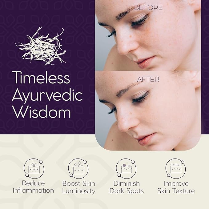 LUVIH Absolute Radiance Brightening Serum – Ayurvedic Dark Spot Corrector & Glow Serum for Women & Men – Nourishing Treatment for Dullness, Uneven Skin Tone & Sun-Stressed Skin – 30 mL