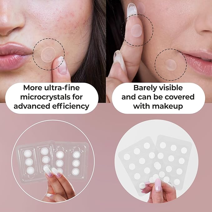 OMMA 72 Patches Pimple Patches for Face and 18 Micropoint Acne Patch Bundle