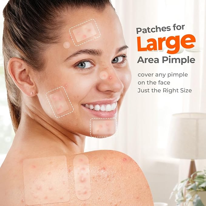 Large Acne Patches for Face, 7 Sizes Big Pimple Patches, XL Hydrocolloid Bandages for Body, Chin, Forehead, Nose, Back Blemish Zit Breakouts, Hydrocolloid Patch (Square, Strip, Dot 142 Count)