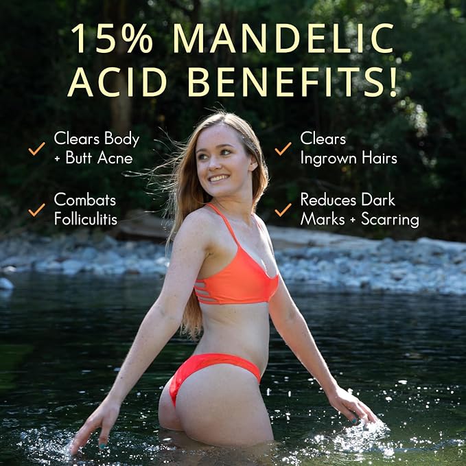 Level 2 Serum | Mandelic Acid Body Serum for Acne, Folliculitis, Aging Skin, Ingrown Hairs, Dark Spots on Face, Chest, Butt, Back, Thighs, Arms | 4 oz