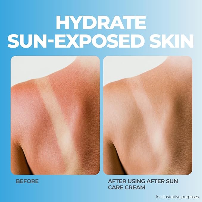 terrasil After Sun Care Lotion with Aloe Vera, Shea Butter, Coconut Oil, & Vitamin E, Soothing Sunburn Relief for Sun Exposed Skin, Deeply Nourishing. Natural Body Lotion (3 oz) Unscented