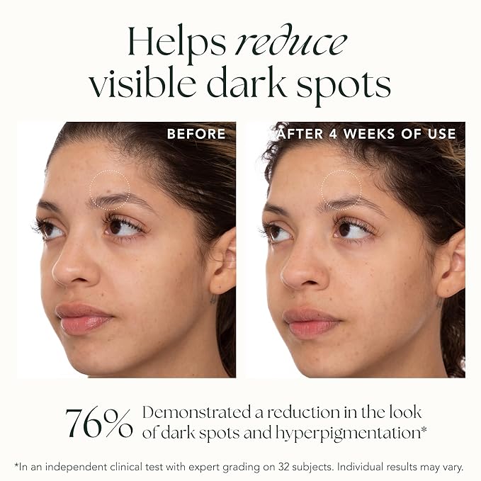 Brightening Saffron Serum - Discoloration Correcting Face Serum, Dark Spot Corrector, Vitamin C Alternative & Hyperpigmentation Treatment - Leaves Skin with a Healthy Glow (1 oz)