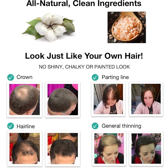 Trial Size - Make Thin Hair Look 10X Fuller. Eliminate Bald Spot and Thinning Hair Instantly. All-Natural Hair Concealer. Salt & Pepper - Light