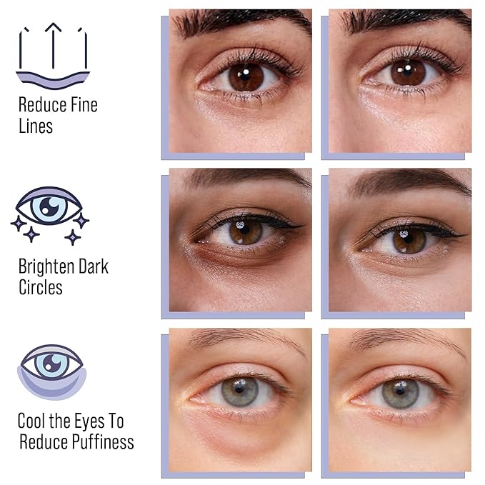 DIAMOND GAZE Under Eye Patches 28 Pairs, Rejuvenate Eye Area, Soothing Hydrate Brighten Skin, Plumps Fine Lines, Hydrogel Eye Mask with Retinol, Niacinamide and Polyglutamic Acid, Eye Gel Pads