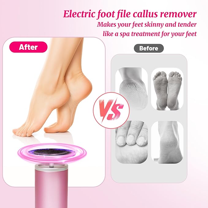 Electric Foot Callus Remover with 80pcs Sandpape Discs, Professional 800RPM Aluminum, Callus Remover for Feet Pedicure Tool for Dead Skin and Calluses, Stepless Speed Control Foot File 2 in 1